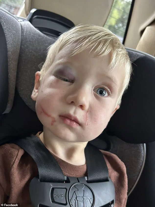 Judge Grants Bail to Daycare Worker Accused of Injuring Child, Faces Threats