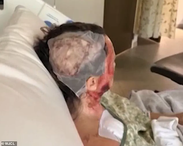 Random Acid Attack in Savannah Sparks Community Concerns Over Public Safety