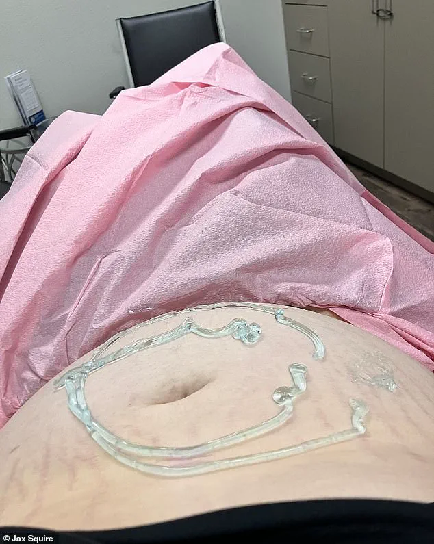 Transgender Man's Unexpected Pregnancy and Adoption Decision Spark Controversy in Rural Texas