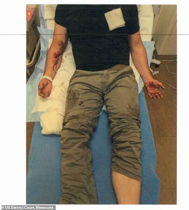 ICE Agent Jonathan Ross Injured in Minneapolis Encounter; Debate Over Lethal Force Intensifies
