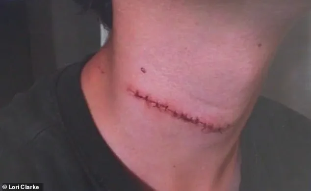 Random Attack Shocks Daytona Beach Family as Teenager Slashed in the Throat
