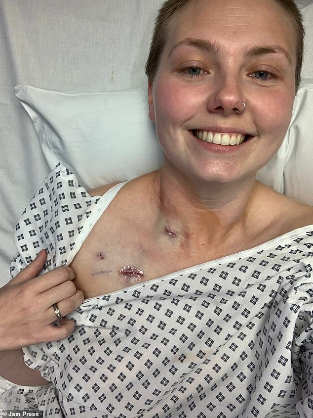 Mother's Early Colon Cancer Symptoms Dismissed As Piles Until Late Diagnosis